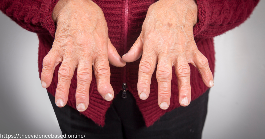 Rheumatoid arthritis, also known as RA is an autoimmune, inflammatory disorder meaning the immune system targets healthy cells within your body. 